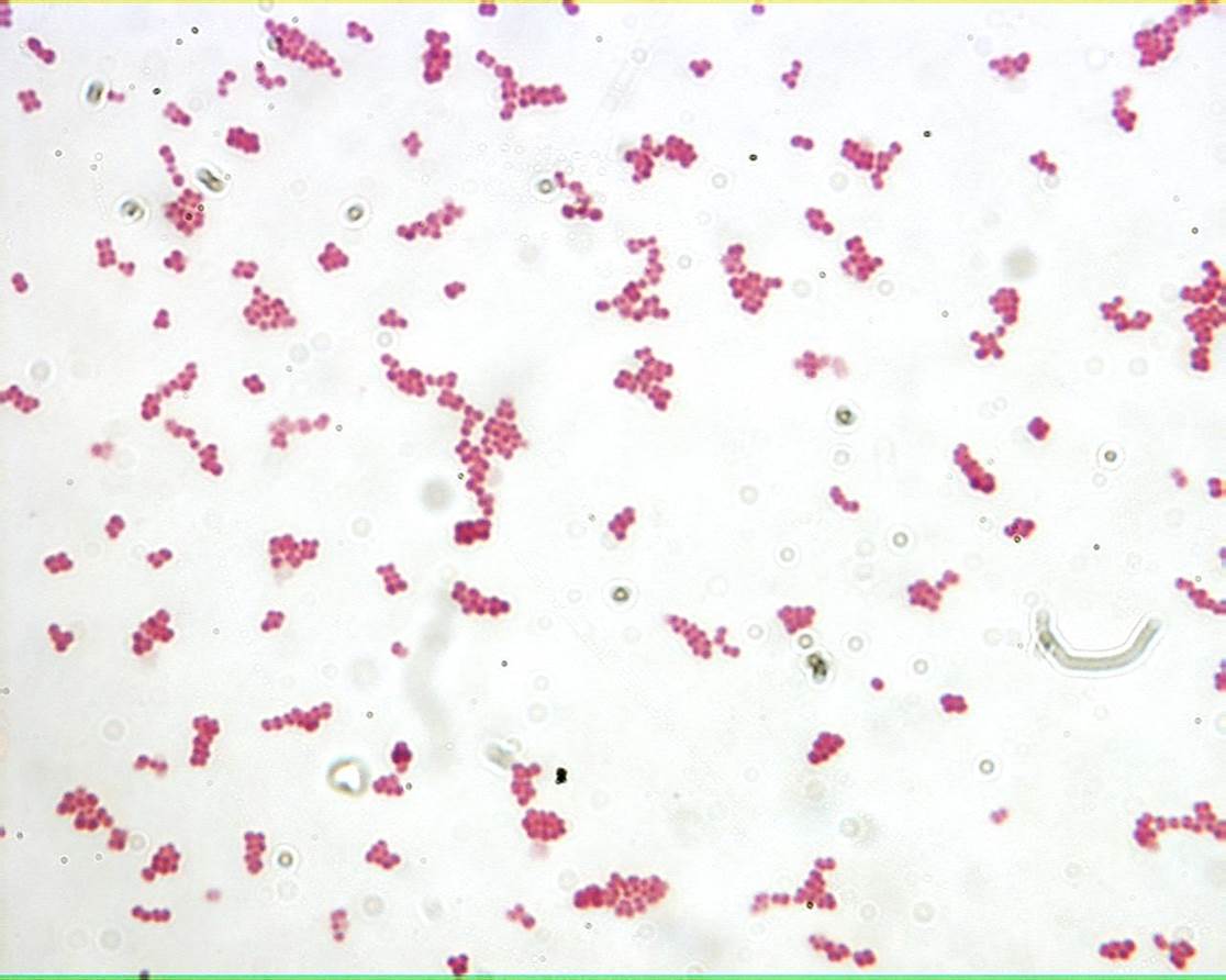 Featured image of post Cocci Bacteria Shape Microscope