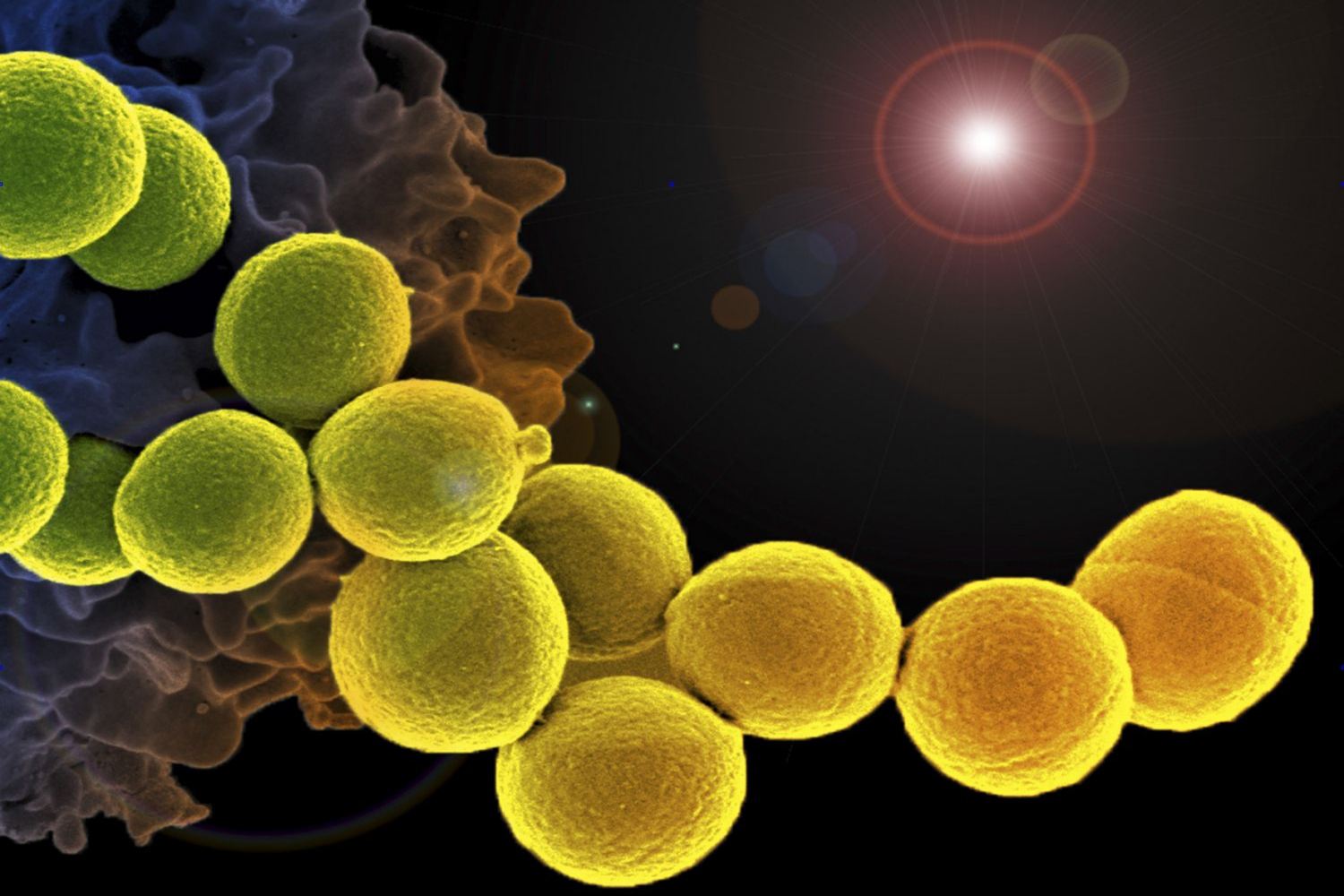 Featured image of post Cocci Bacteria Shapes