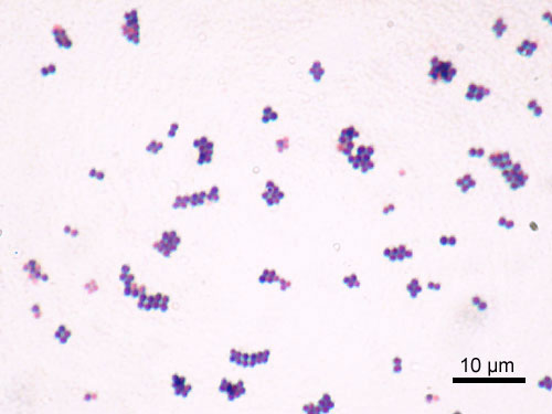 Featured image of post Cocci Shaped Bacteria Examples