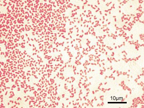 Featured image of post Gram Negative Cocci Shaped Bacteria