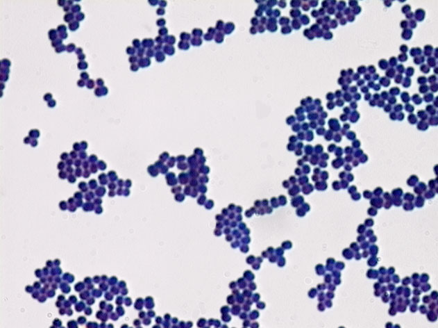 Featured image of post Gram Positive Cocci Shaped Bacteria