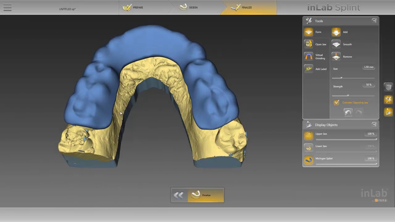 Featured image of post Michigan Splint Fabrication